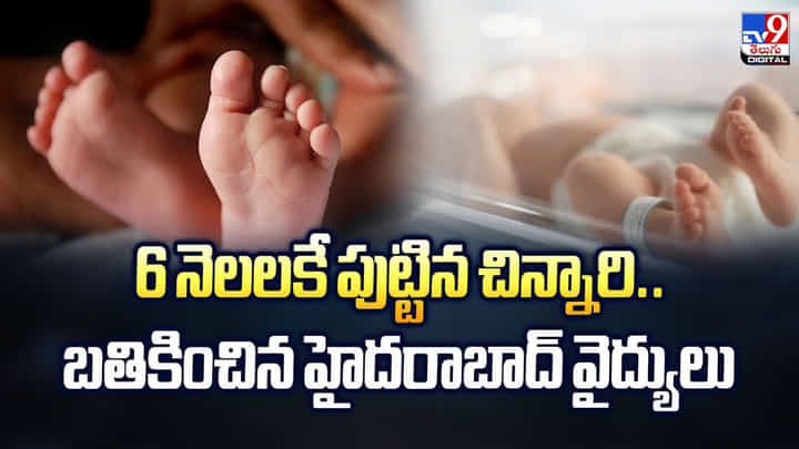 6 నెలలకే పుట్టిన చిన్నారి.. బతికించిన హైదరాబాద్ వైద్యులు 6 నెలలకే పుట్టిన చిన్నారి.. బతికించిన హైదరాబాద్ వైద్యులు