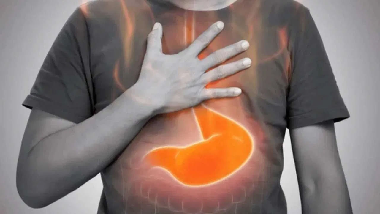 అసిడిటీకి: అసిడిటీ ఉన్నప్పుడు చల్లటి నీరు తాగడం వల్ల కడుపులో చికాకు తగ్గుతుంది. అయితే భోజనం చేసిన వెంటనే ఎక్కువ నీరు తాగడం వల్ల జీర్ణ రసాలు పలుచన అవుతాయి. ఇది యాసిడ్ రిఫ్లక్స్ సమస్యను పెంచుతుంది.
