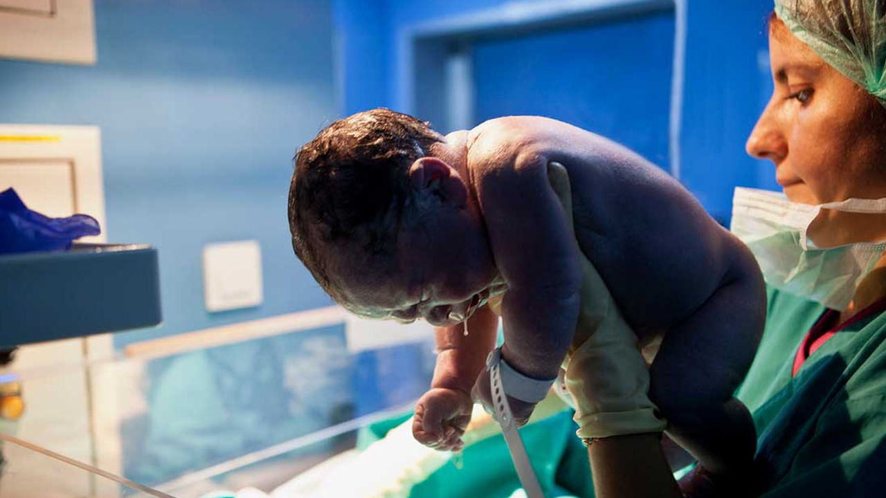 ఒక వేల పుట్టిన వెంటనే బిడ్డ ఏడవకపోతే.. డాక్టర్ వెంటనే శిశువును పరీక్షిస్తాడు. బిడ్డను చేతుల్లోకి తీసుకొని బిడ్డను వెనక్కి తిప్పి వీపుపై నెమ్మదిగా కొడతారు. అప్పుడు బిడ్డ ఏడవడం స్టార్ట్ చేస్తుంది. 
