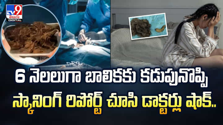 6 నెలలుగా బాలికకు కడుపునొప్పి.. స్కానింగ్ రిపోర్ట్ చూసి డాక్టర్లు షాక్ వీడియో 6 నెలలుగా బాలికకు కడుపునొప్పి.. స్కానింగ్ రిపోర్ట్ చూసి డాక్టర్లు షాక్ వీడియో