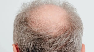 వాల్‌నట్స్‌ డైట్ చేర్చితే.. ఆ సమస్యలపై దండయాత్ర చేసినట్టే..