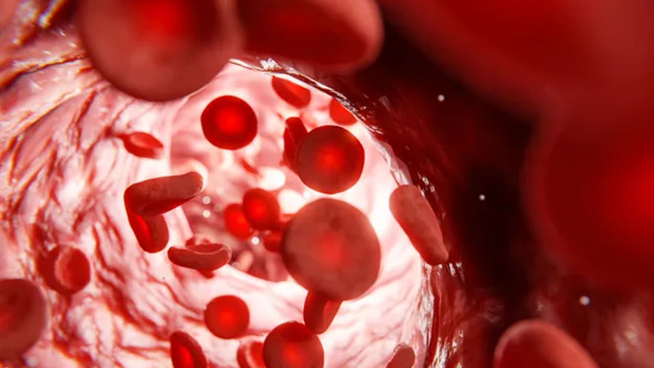 Blood Cance4