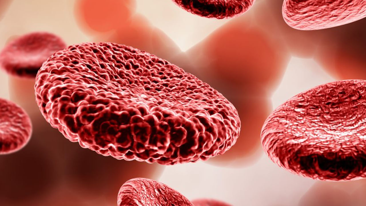 Blood Cance5
