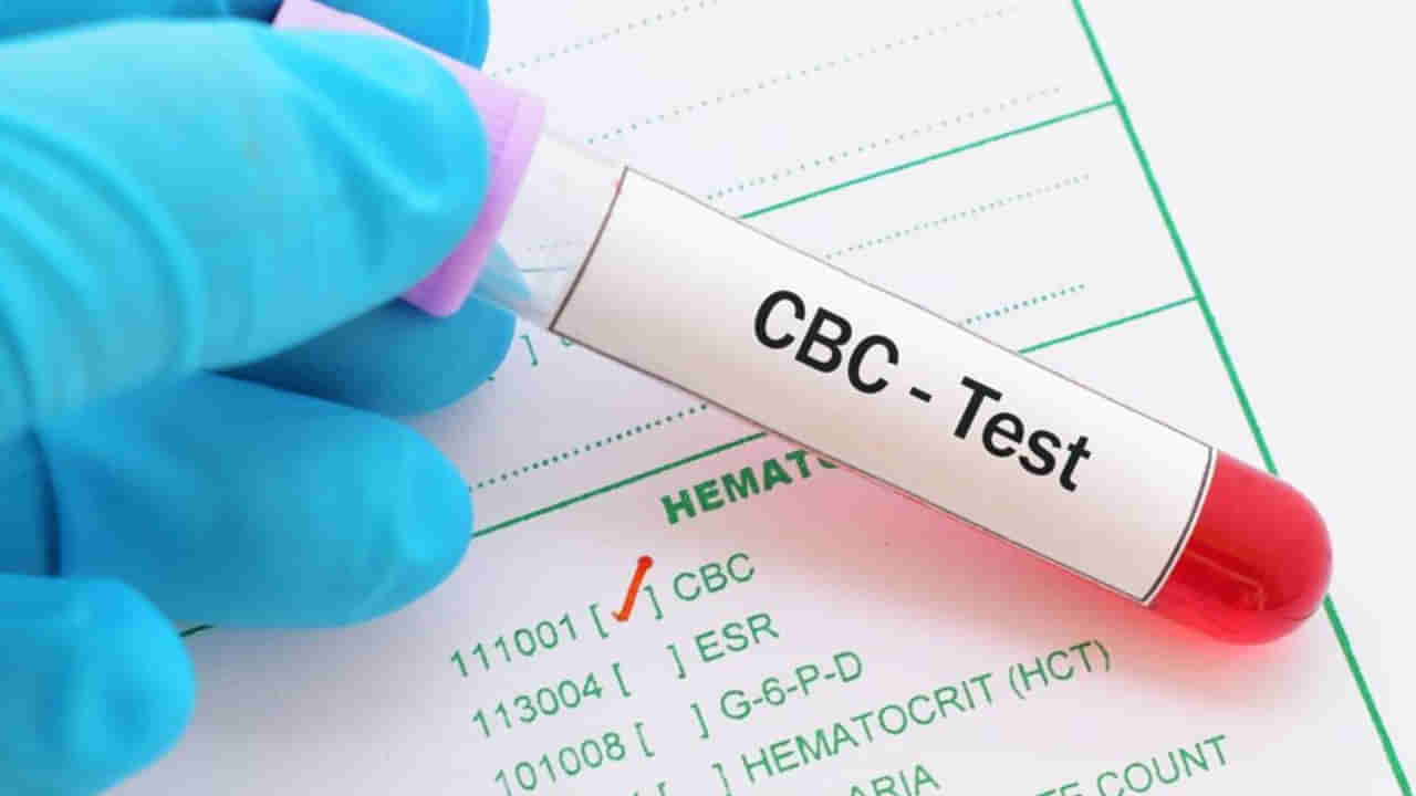 CBC పరీక్ష అంటే ఏమిటి? .. ఇంతకు దీనిని ఎందుకు చేస్తారో తెలుసా?