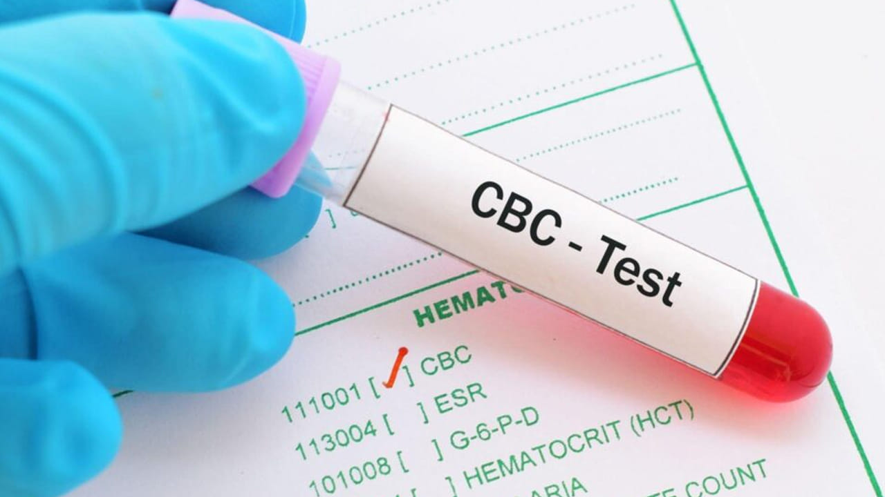CBC పరీక్ష అంటే ఏమిటి? .. ఇంతకు దీనిని ఎందుకు చేస్తారో తెలుసా?