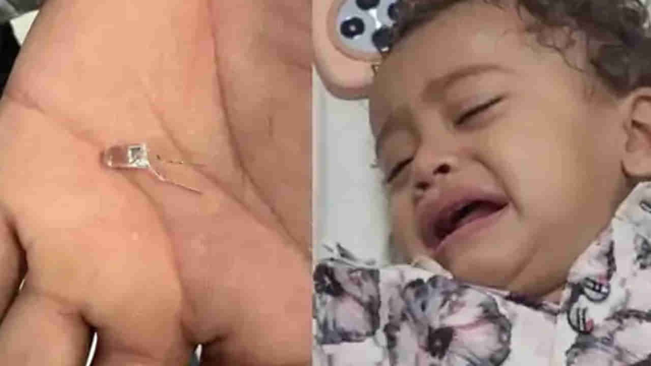 Viral: నోట్లో అన్నం పెడితే చాలు.. బుడ్డోడికి వాంతులు.. ఆస్పత్రికి తీసుకెళ్లి టెస్టులు చేయగా..