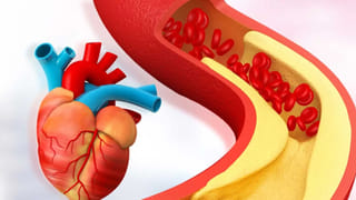 Dog Bite: కుక్క కరిచిన వెంటనే ఏంచేయాలి..? ఎన్ని ఇంజెక్షన్లు తీసుకోవాలి..? ఈ తప్పులు అసలు చేయొద్దు..