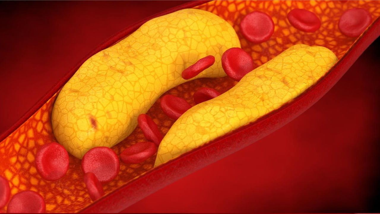 కొలెస్ట్రాల్ అనేది కణ త్వచాలలో కనిపించే కొవ్వు, జిడ్డుగల స్టెరాయిడ్... ఇది రక్త సిరల్లో ఫలకం పేరుకునేలా చేసి.. రక్తం సరఫరాకు అడ్డంకిగా మారుతుంది. చెడు కొలెస్ట్రాల్ పెరిగి అధిక రక్తపోటు, గుండెపోటు, బ్రెయిన్ స్ట్రోక్‌కు మరింత కారణమవుతుందని నిపుణులు చెబుతున్నారు వాస్తవానికి కొలెస్ట్రాల్ రెండు రకాలు.. అధిక సాంద్రత కలిగిన లిపోప్రొటీన్ (HDL) - మంచి కొలెస్ట్రాల్, తక్కువ సాంద్రత కలిగిన లిపోప్రొటీన్ (LDL) చెడు కొలెస్ట్రాల్ గా పరిగణిస్తారు..