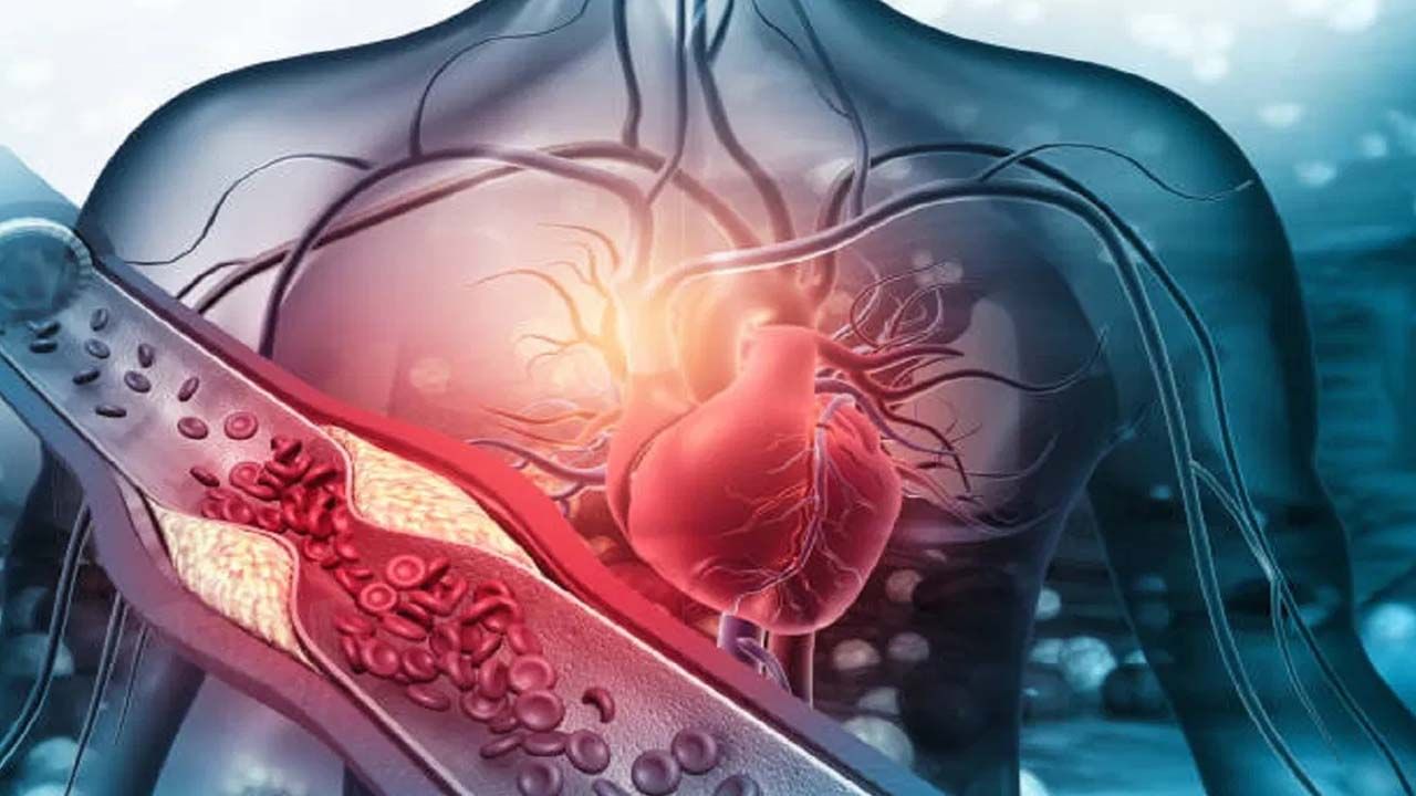 Cholesterol 3