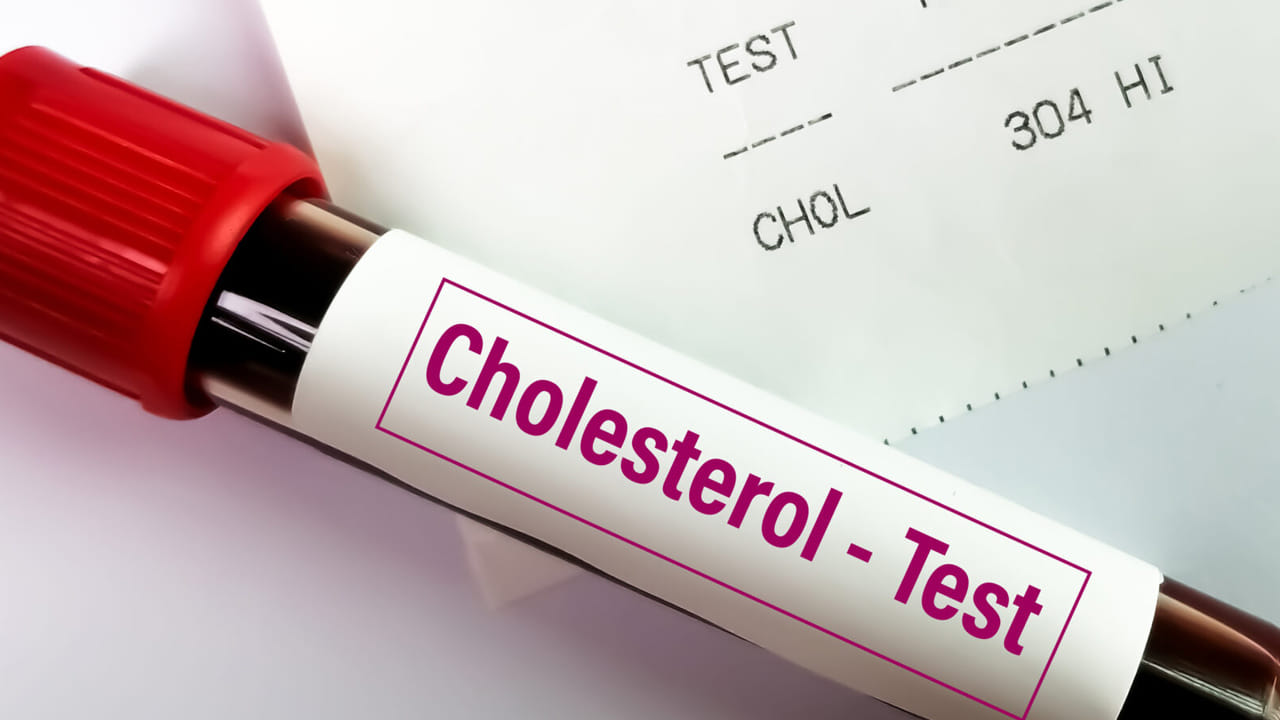 తీసుకుంటున్న ఆహారం జీవనశైలి కారణంగా చాలా మంది అనారోగ్య సమస్యల భారిన పడుతున్నారు.మరీ ముఖ్యంగా ఈ మధ్య చాలా మంది అధిక కొలెస్ట్రాల్తో సమస్యలు ఎదుర్కోవాల్సి వస్తుంది. అయితే మీ కుటుంబంలో ఎవ్వరికైనా సరే హై కొలెస్ట్రాల్ ఉంటే మీరు కూడా ప్రమాదంలో ఉన్నారో లేదో తెలుసుకోవడం చాలా ముఖ్యం అంటున్నారు ఆరోగ్య నిపుణులు. కాగా, మనం దీని గురించిన పూర్తి సమాచారం తెలుసుకుందాం.