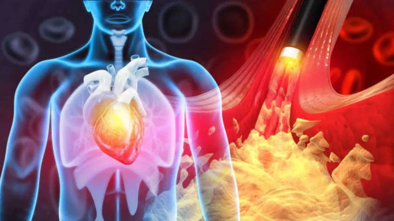 Cholesterol Health Risk
