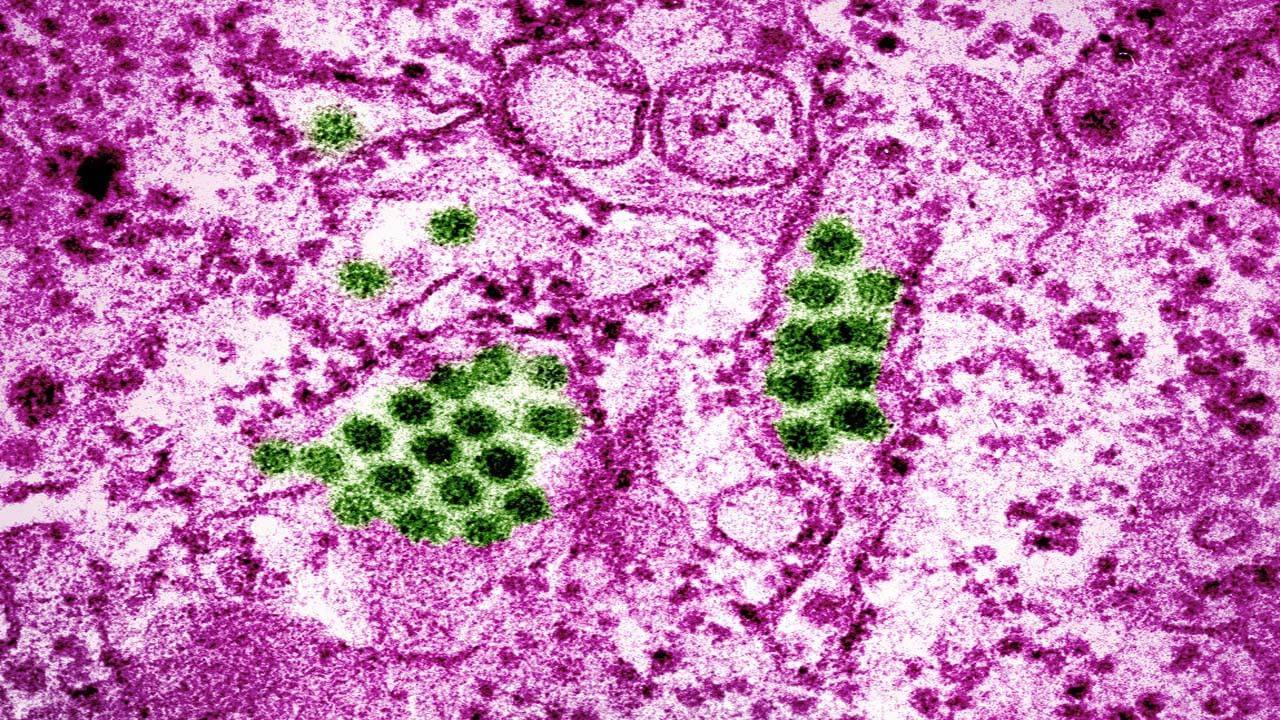 ఎయిమ్స్ వైద్యులు దీనిని ఒక పరిశోధన ద్వారా చికిత్స చేశారు. ఇందులో సోకిన కణాలలో miR-133a అణువుల సంఖ్యను కృత్రిమంగా పెంచారు. దీని కారణంగా డెంగ్యూ వైరస్ పెరగడంలో ఇబ్బంది పడింది. miR-133a సంఖ్య పెరిగినప్పుడు, వైరస్ తనను తాను సులభంగా ప్రతిరూపం చేసుకోలేకపోయిందని పరిశోధనలో వెల్లడైంది.