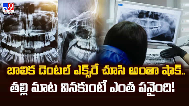 బాలిక డెంటల్ ఎక్స్రే చూసి అంతా షాక్.. తల్లి మాట వినకుంటే ఎంత పనైంది బాలిక డెంటల్ ఎక్స్రే చూసి అంతా షాక్.. తల్లి మాట వినకుంటే ఎంత పనైంది