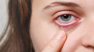 Sneezing Risks: వామ్మో.. తుమ్మును ఆపుకుంటే ఇంత డేంజరా..? వైద్యులు చెప్పేది ఏంటంటే..