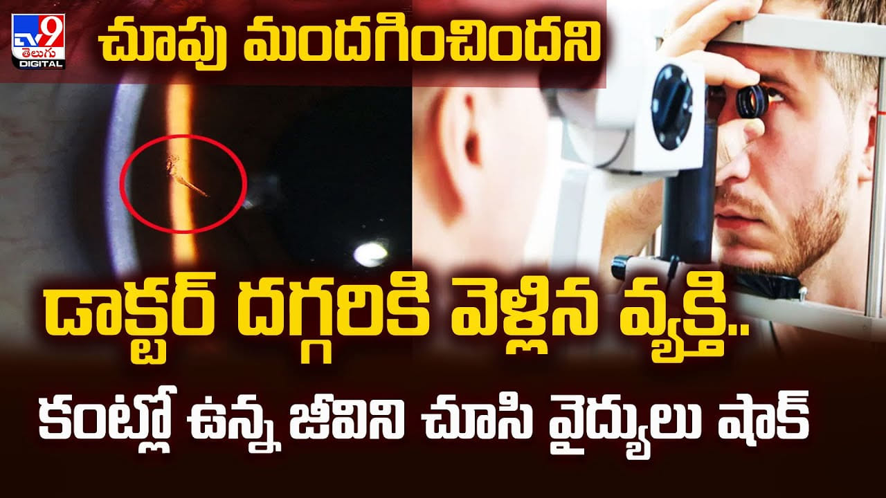 చూపు మందగించిందని డాక్టర్ దగ్గరికి వెళ్లిన వ్యక్తి.. కంట్లో ఉన్న జీవిని చూసి వైద్యులు షాక్‌ వీడియో