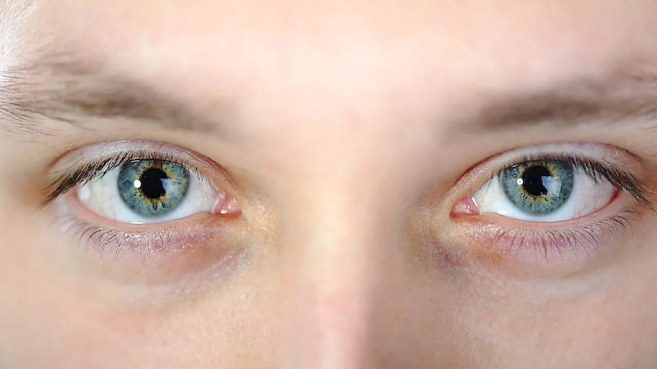 కంటి వ్యాధులు: భారత్ ప్రపంచంలోనే అత్యధిక కంటిశుక్లం శస్త్రచికిత్సలు చేసే దేశమని వైద్యులు అంటున్నారు. ప్రస్తుతం పెరుగుతున్న మయోపియా (దూరపు వస్తువులు అస్పష్టంగా కనిపించడం) సమస్య ఒక కొత్త సవాలుగా మారింది. దీనిని నివారించడానికి పోషకాహారం, సకాలంలో కంటి పరీక్షలు, జీవనశైలిలో మార్పులు అవసరమని నిపుణులు సూచిస్తున్నారు.