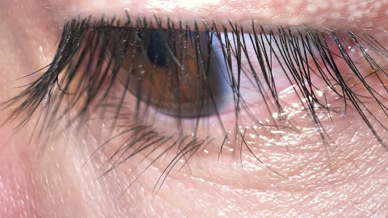 కంటి ఇన్ఫెక్షన్: వ్యక్తిగత పరిశుభ్రత చాలా ముఖ్యం. అయితే ఈ రూల్ మేకప్ విషయంలో కూడా పాటించాల్సిందే. లేకుంటే కంటి ఇన్ఫెక్షన్స్ వంటి సమస్యలను ఎదుర్కోవాల్సి వస్తుంది. మేకప్లో పరిశుభ్రత ఎలా ఉంటుందనుకుంటున్నారా? మేకప్లో కూడా పరిశుభ్రత అవసరం. ఇతరులు ఉపయోగించిన బ్రష్, ఐల్యాష్ మొదలైన వాటిని ఉపయోగించడం ద్వారా వ్యాధుల బారిన పడవచ్చు. మేకప్ వస్తువులను వీలైనంత వరకు డస్ట్ ఫ్రీ ప్లేస్లో ఉంచడానికి ప్రయత్నించాలి.