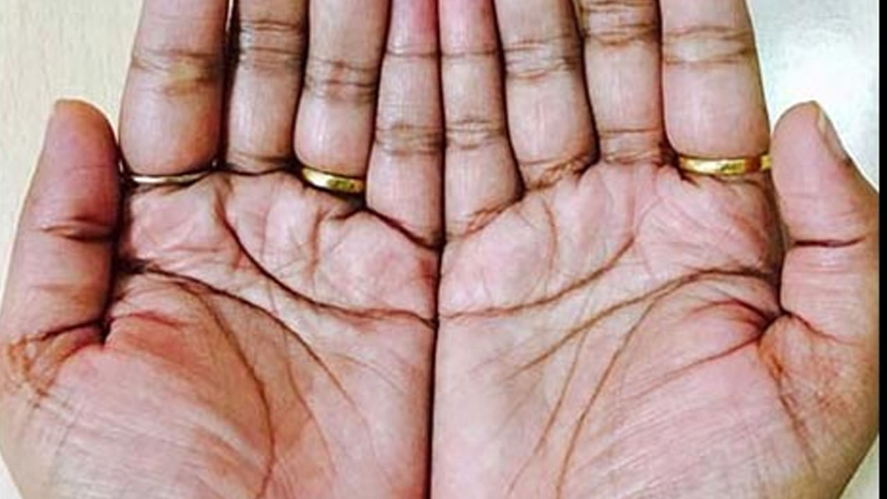 రెండు చేతుల్లోని హృదయ రేఖలు సమానంగా ఉంటే: మీ రెండు చేతుల్లోని హృదయ రేఖలు సమానంగా ఉంటే, మీరు సామరస్యంగా జీవించే వ్యక్తి అని అర్థం. మీరు తెలియని వారితో కూడా ఈజీగా కలిసిపోతారు. మీరు ఎప్పుడూ శాంతియుతంగా, సంయమనంతో ఉండాలనుకుంటారు. 