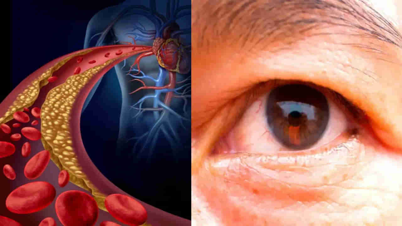 మీ కళ్ళలో ఈ గుర్తులు కనిపిస్తున్నాయా..? అయితే మీ ఆరోగ్యం డేంజర్లో ఉన్నట్లే..
