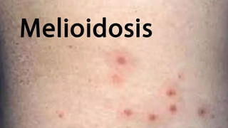 Andhra: లేడి డాన్ అరుణ పెద్ద కి’లేడీ’.. వామ్మో.! లిస్టు పెద్దదే ఉందిగా.. చూస్తే అవాక్