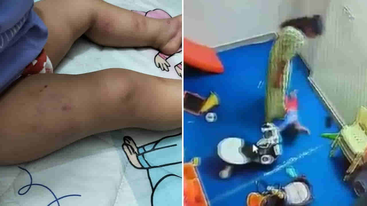 Daycare Horror: డే కేర్లో విచక్షణారహితంగా చిన్నారిపై దాడి.. శరీరంపై దెబ్బలు, గాట్లు.. వీడియో వైరల్