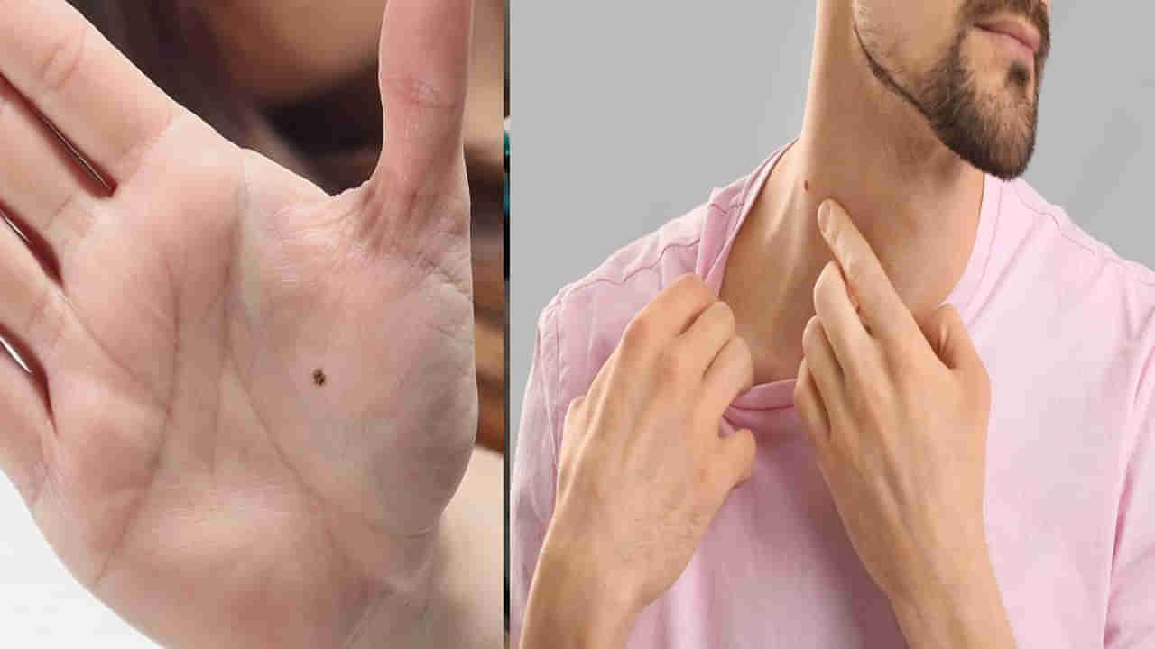 Samudrika Shastra: పురుషులకు ఈ శరీర భాగాలపై పుట్టుమచ్చలుంటే రాజయోగం.. సిరి సంపదలకు లోటు ఉండదు..