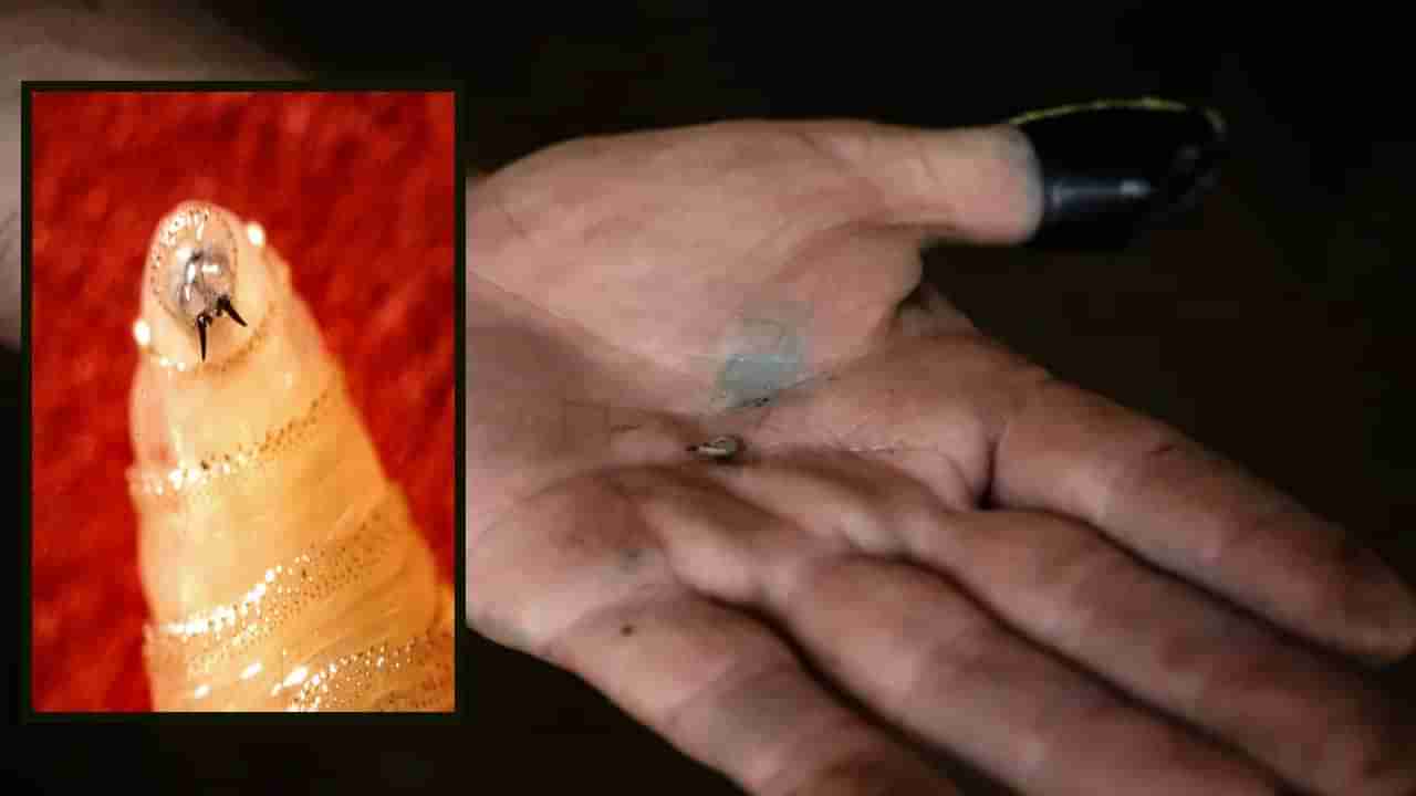 వామ్మో.. నరభక్షక పురుగులు.. మనుషుల మాంసం రుచి మరిగి స్క్రూవార్మ్..!