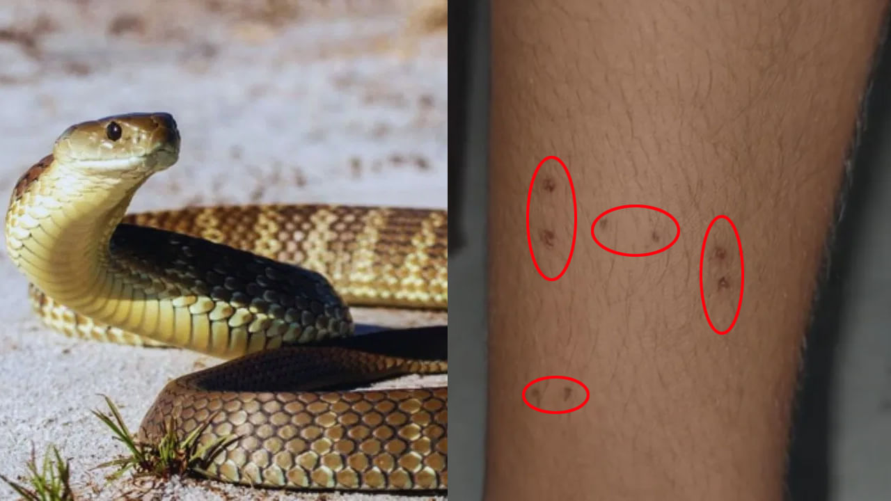 ఇదెక్కడి వింత.. బాలికను ఒకే నెలలో, ఒకే చోటా ఐదు సార్లు కాటేసిన పాము!.. చివరకు ఏం జరిగిందంటే?