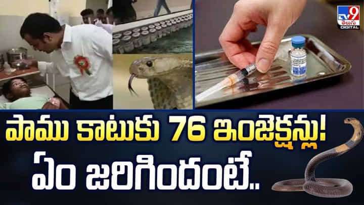 పాము కాటుకు 76 ఇంజెక్షన్లు! ఏం జరిగిందంటే పాము కాటుకు 76 ఇంజెక్షన్లు! ఏం జరిగిందంటే