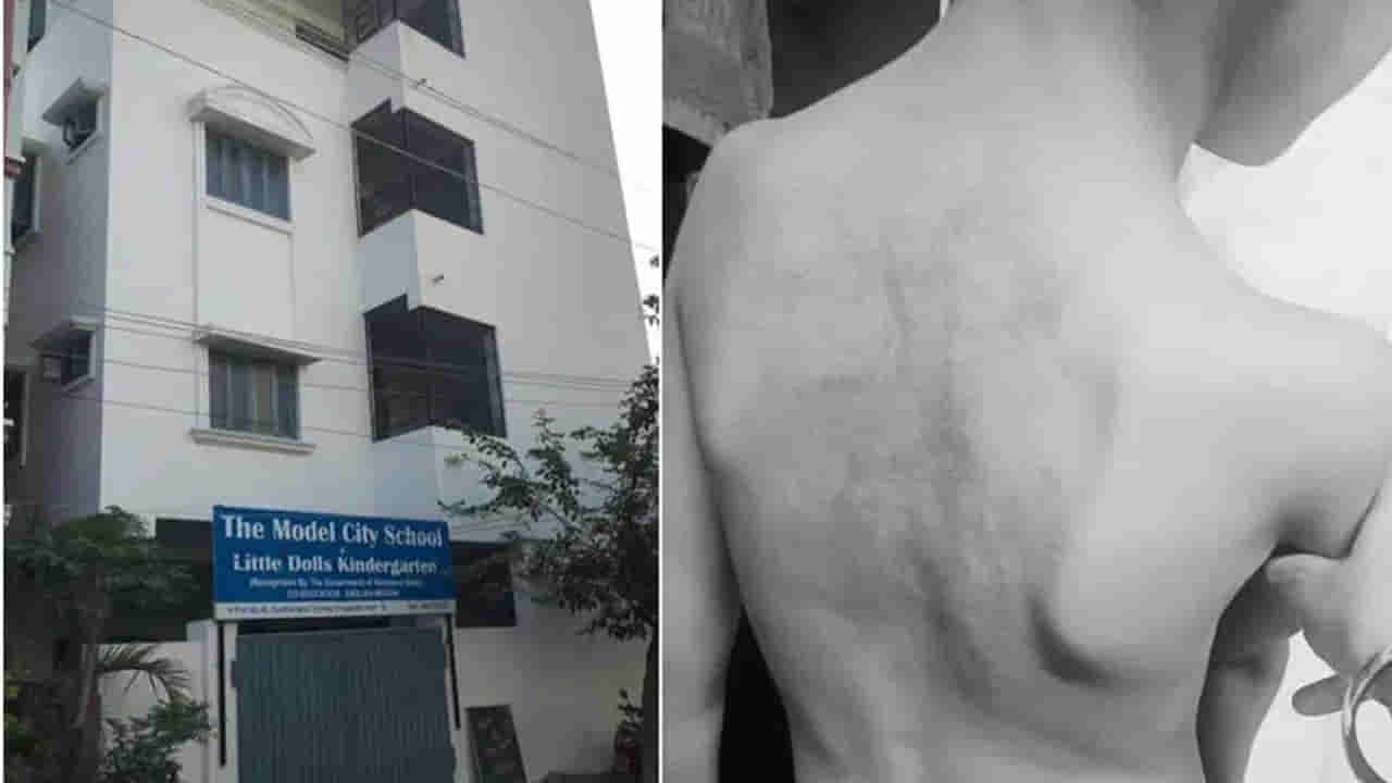 Hyderabad: తికమకలో వేరే బుక్‌ ఇచ్చాడనీ.. ఒకటో తరగతి పిల్లాడిని చితకబాదిన లేడీ టీచర్‌!