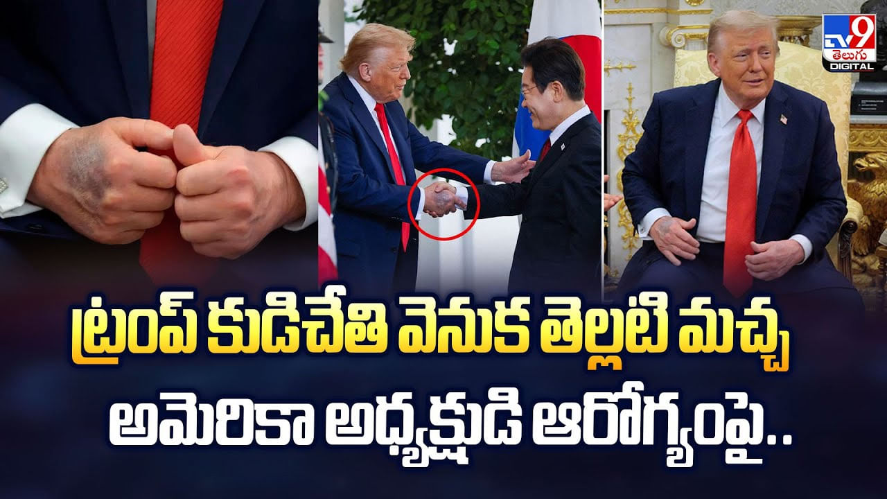 ట్రంప్‌ కుడిచేతి వెనుక తెల్లటి మచ్చ..అమెరికా అధ్యక్షుడి ఆరోగ్యంపై – Telugu News | Donald Trump’s Mysterious Hand Mark Just A Bruise Or Something Bigger video – World Videos in Telugu