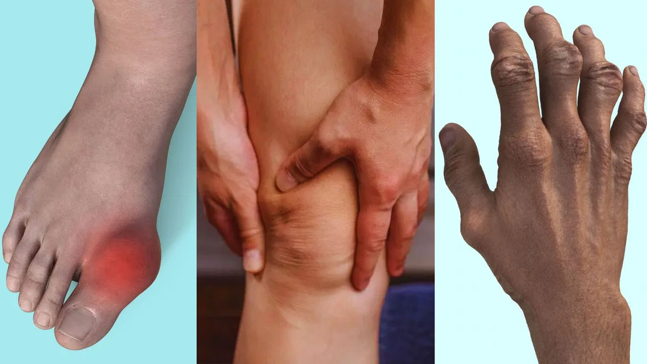 పెద్దగా పట్టించుకోరు కానీ.. ఈ లక్షణాలు యమ డేంజర్.. వేళ్లు, పాదాలలో వాపు ఎందుకు వస్తుందో తెలుసా..?