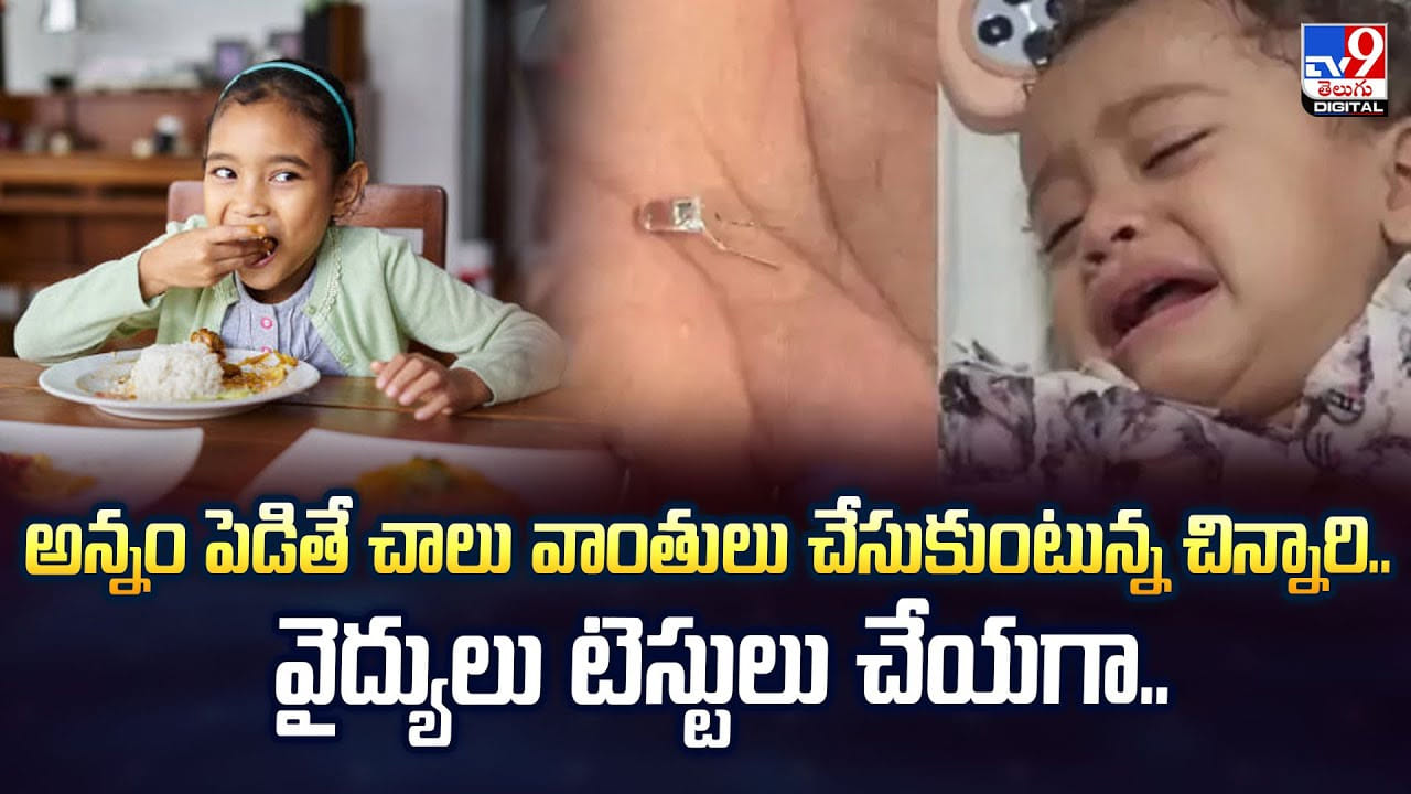 అన్నం పెడితే చాలు వాంతులు చేసుకుంటున్న చిన్నారి.. వైద్యులు టెస్టులు చేయగా