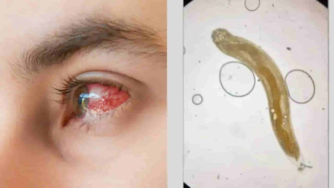 Viral: కళ్లు మసకబారిపోయి ఆస్పత్రికి వెళ్లిన 35 ఏళ్ల వ్యక్తి.. ఎక్స్‌రేలో కనిపించింది చూసి అంతా షాక్