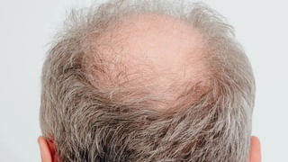 ఇదో వింత వ్యాధి.. 60రోట్టెలు తిన్నా ఆకలి తీరని రోగం..! చికిత్స లక్షల్లోనే..