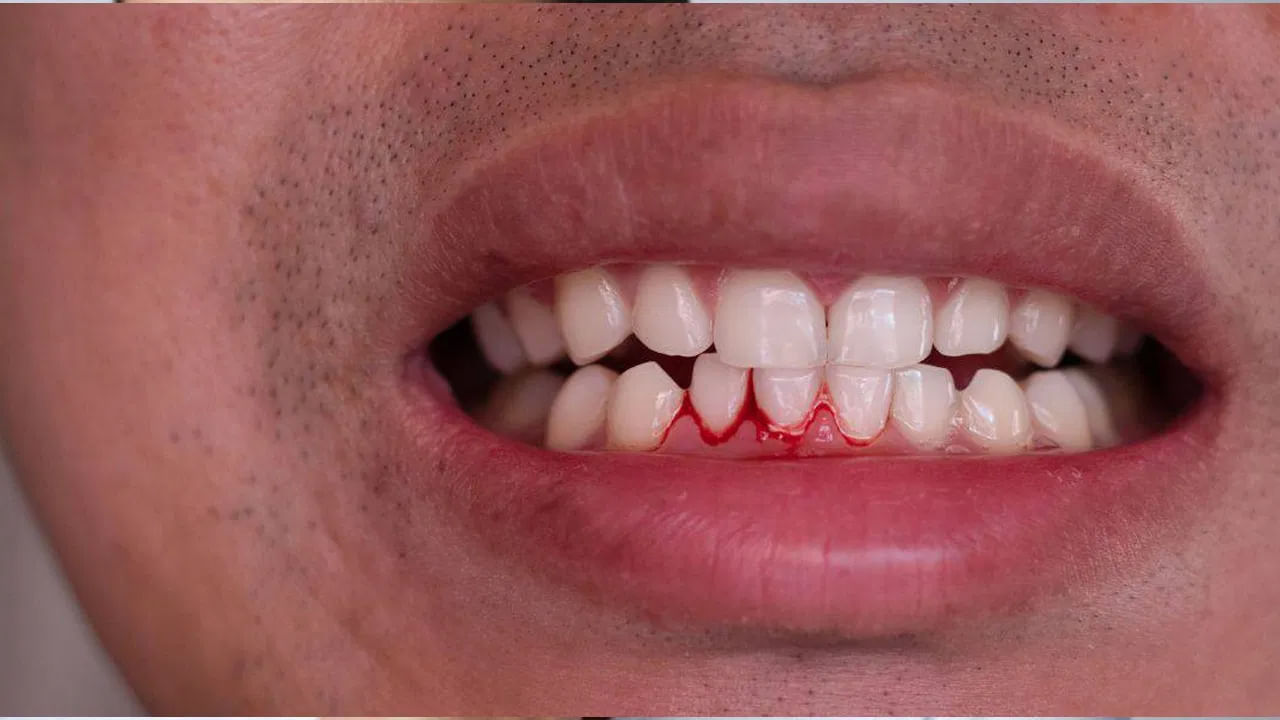 Blood On Teeth