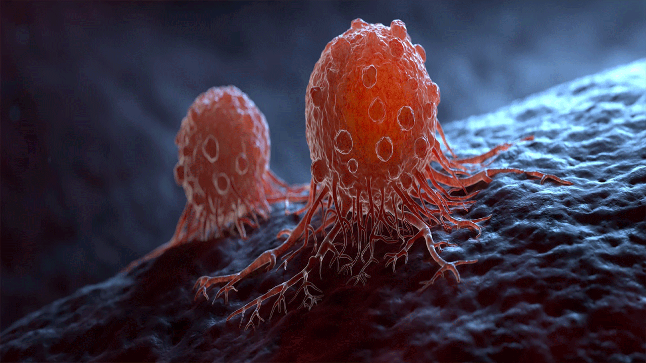 క్యాన్సర్ కేవలం జన్యుపరమైన వ్యాధి మాత్రమే కాదు. క్యాన్సర్ వెనుక ఇంకా చాలా కారణాలు ఉన్నాయి. క్యాన్సర్ సోకడానికి ప్రధాన కారణం మన జీవనశైలి అలవాట్లు. ఉదాహరణకు, ఎక్కువసేపు కూర్చోవడం నుండి పొగలుకక్కే వేడి టీ తాగడం వరకు ఇవన్నీ శరీరంలో మార్పులకు కారణమవుతాయి. ఇవి కణాలను మరింత సున్నితంగా చేస్తాయి. క్యాన్సర్ వంటి వ్యాధుల ప్రమాదాన్ని పెంచుతాయి.