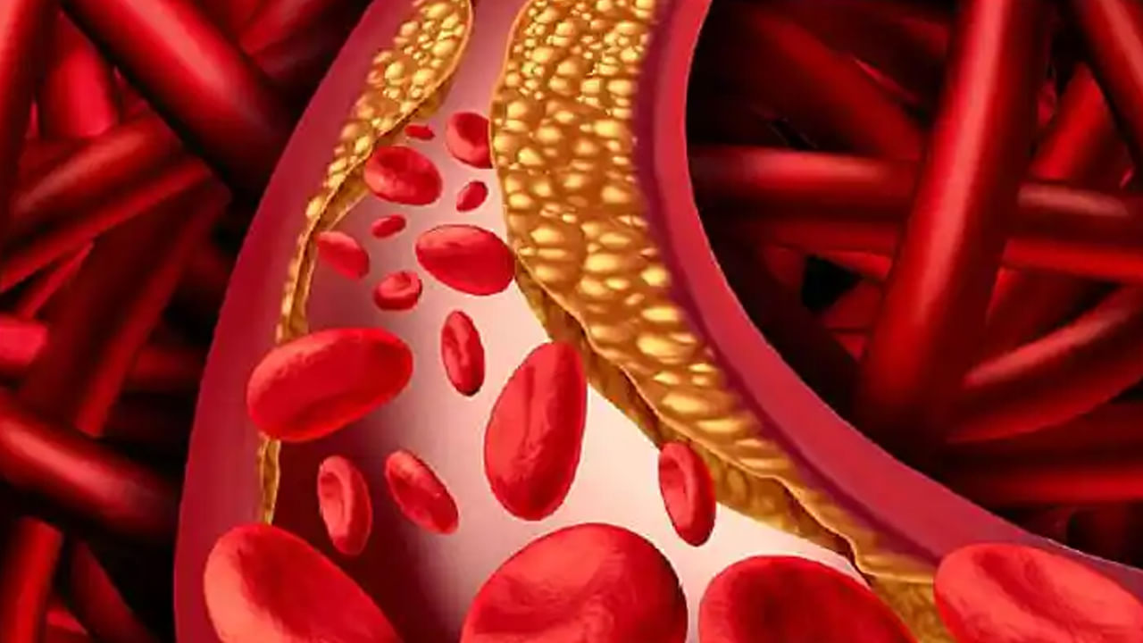 శుద్ధి చేసిన నూనె, పామాయిల్, ఇతర సంతృప్త కొవ్వులు ఉన్న ఆహారాన్ని తినకపోవడమే మంచిదని నిపుణులు చెబుతున్నారు. అయితే, కొలెస్ట్రాల్ స్థాయిలను తగ్గించడానికి సోంపు-జీలకర్ర నీరు అద్బుతమైన ఔషధంగా పనిచేస్తుందని నిపుణులు చెబుతున్నారు. 