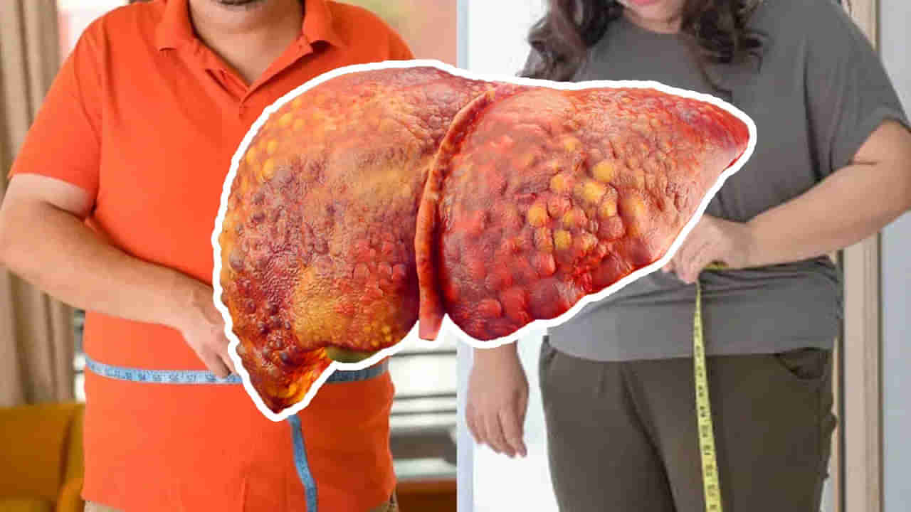 ఫ్యాటీ లివర్‌‌కు పవర్‌ఫుల్ ఛూమంత్రం.. ఇలా చేస్తే కాలేయానికి పట్టిన మురికంతా మటాషే..