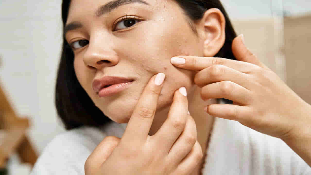Skin Care: ముఖంపై జిడ్డు వదలడం లేదా.. వానాకాలంలో ఈ జాగ్రత్తలు తప్పనిసరి