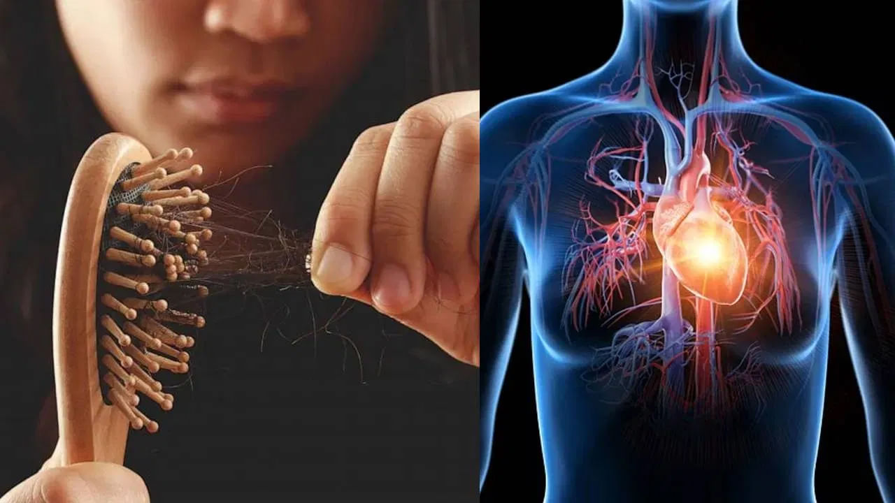 అకస్మాత్తుగా బట్టతల రావడం అనేది కేవలం కాస్మెటిక్ సమస్య మాత్రమే కాదు. ఇది గుండెపోటుకు సంకేతం కూడా కావచ్చు. అందుకే జుట్టు రాలడానికి, గుండెపోటుకు మధ్య ఉన్న సంబంధాన్ని తెలుసుకోవడం చాలా ముఖ్యం. చాలా మందికి ఆకస్మిక బట్టతల సమస్యతో బాధపడుతుంటారు. దానిని కేవలం సౌందర్య సమస్యగా విస్మరిస్తారు. కానీ ఆకస్మిక బట్టతల గుండె ఆరోగ్యానికి సంబంధించినదని మీకు తెలుసా? జుట్టు రాలడం, గుండెపోటు మధ్య సంబంధం చాలా లోతైనదని వైద్యులు అంటున్నారు.