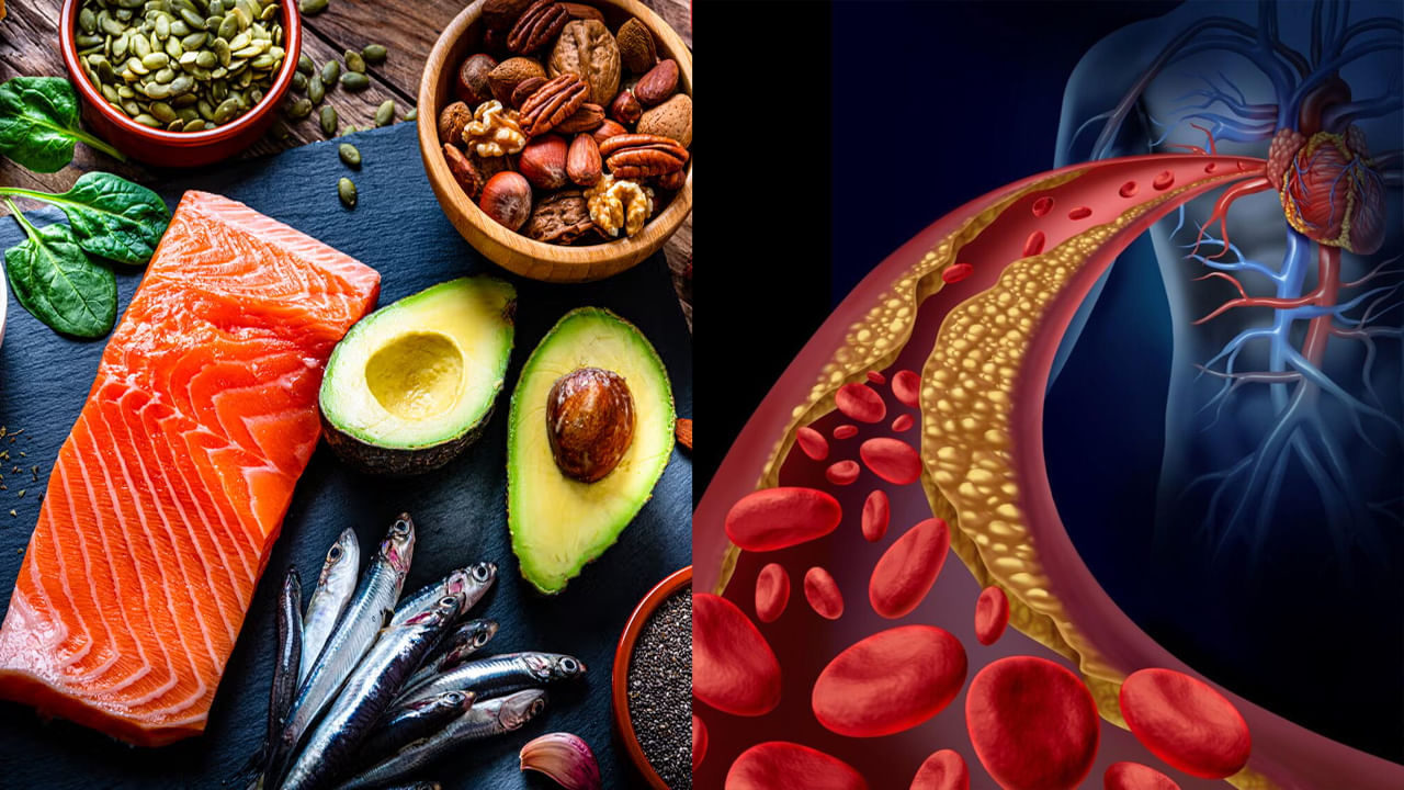 Cholesterol Diet: ఒంట్లో కొవ్వును దశల వారీగా కరిగించే పంచ తంత్రాలు.. ఓ లుక్‌ వేస్కోండి