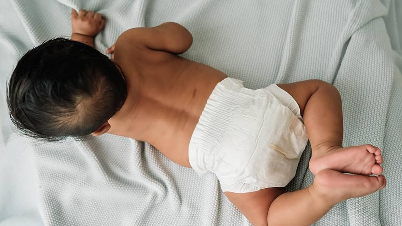 వాజెలీన్‌తో సహాయంతో కూడా డైపర్ వేయడం వల్ల వచ్చే దద్దుర్లు, మంట, దురద, ర్యాషెస్‌ను తగ్గించుకోవచ్చు. వాజెలీన్ చర్మాన్ని మెత్తబరచి.. సమస్య తగ్గేలా చేస్తుంది. ఇవన్నీ పాటిస్తే ఎలాంటి సమస్యలు ఉండవని అంటున్నారు నిపుణులు.