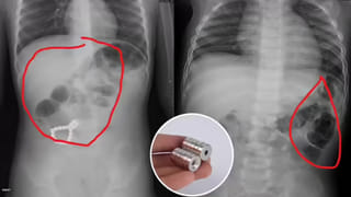 Viral Video: వీడెవడండి బాబు.. ఓడిపోతే మాత్రం ఇలా వర్షంలో తడవాలా?… ఏకంగా అమెరికా గ్రాండ్‌మాస్టర్‌నే ఫిదా చేశాడుగా