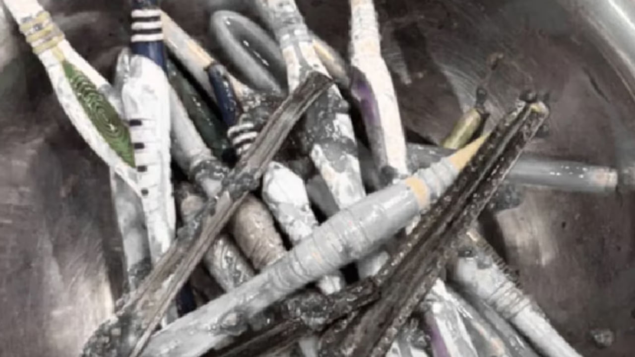 Viral: తీవ్రమైన కడుపునొప్పి ఉంటే ఆస్పత్రికి తీసుకెళ్లారు.. స్కాన్ చేయగా అతని కడుపులో