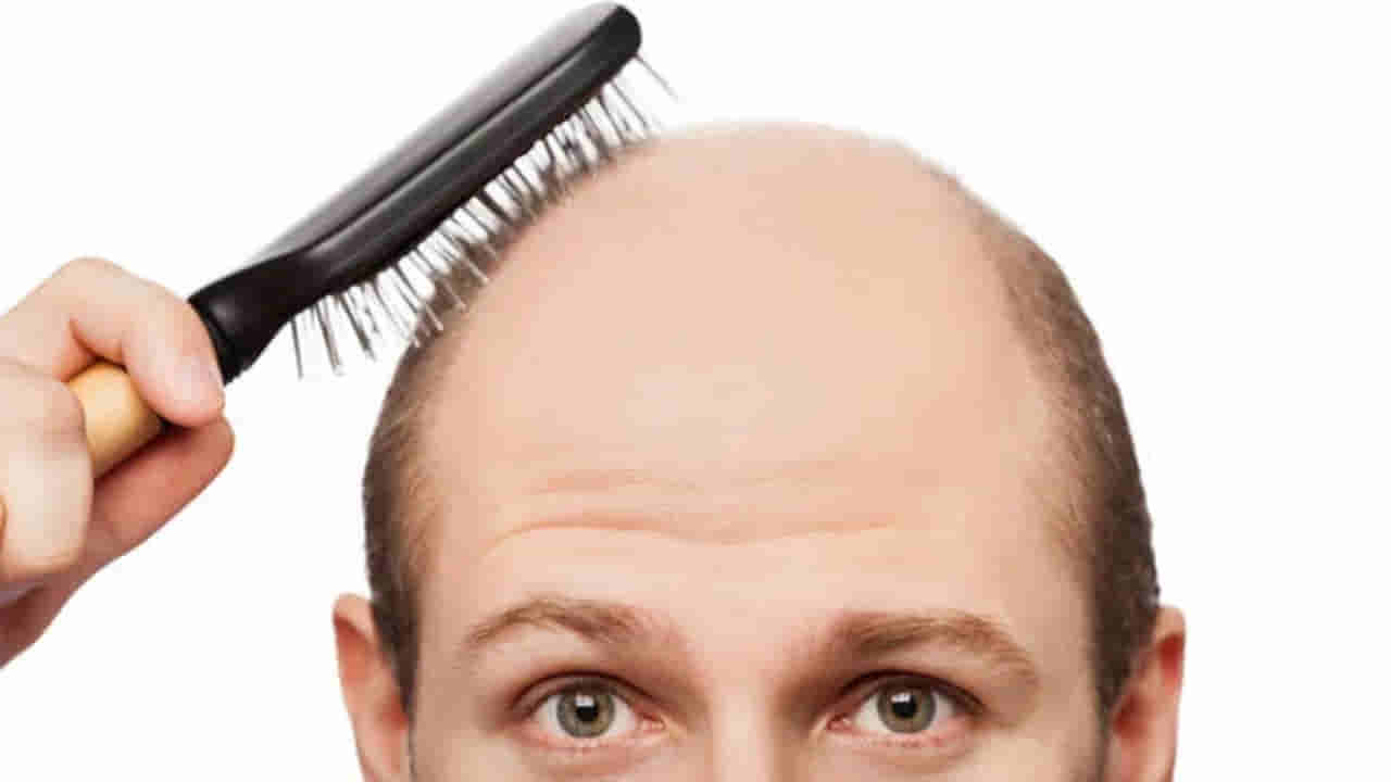 Baldness Cure: దేవుడా! ఇక బట్టతల మాయం... జుట్టు తిరిగి పెంచే మందు కనిపెట్టారు!