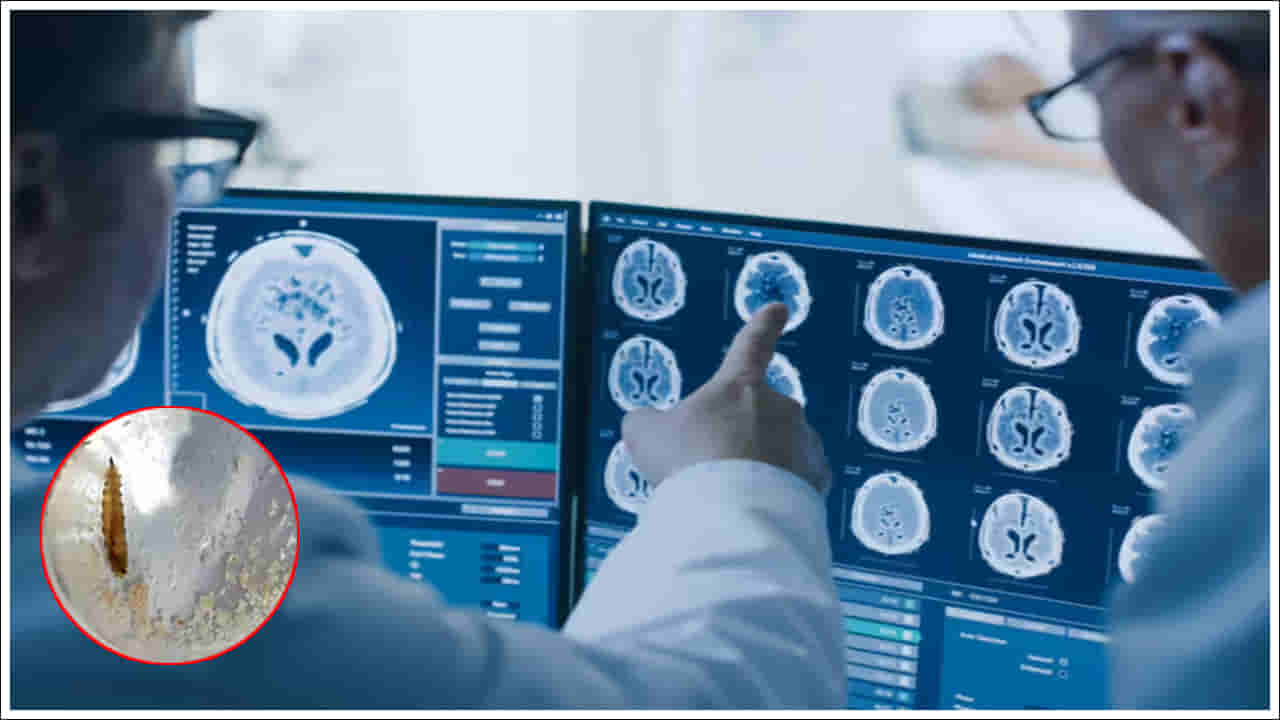 Andhra Pradesh: ఆమెకు తరచూ తలనొప్పి.. ఆస్పత్రికి తీసుకెళ్లగా.. మెదడులో దాన్ని చూసి డాక్టర్లు షాక్