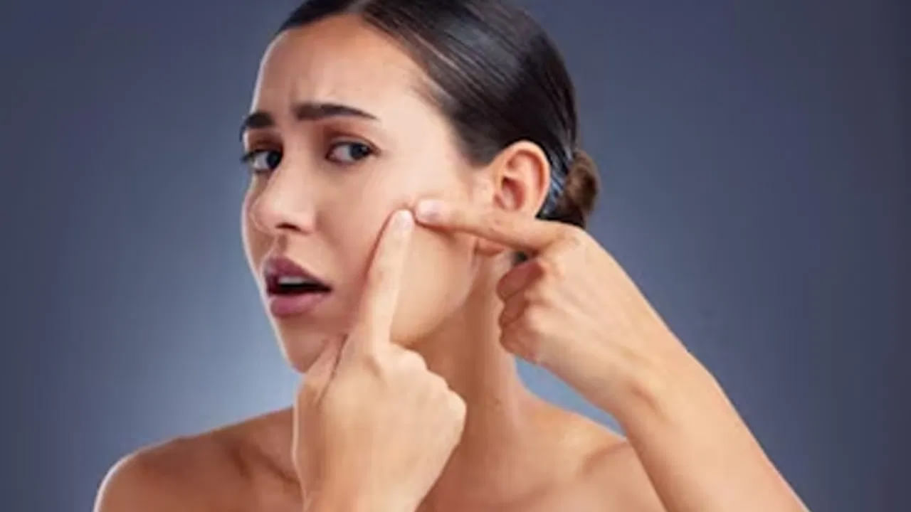 Pimple