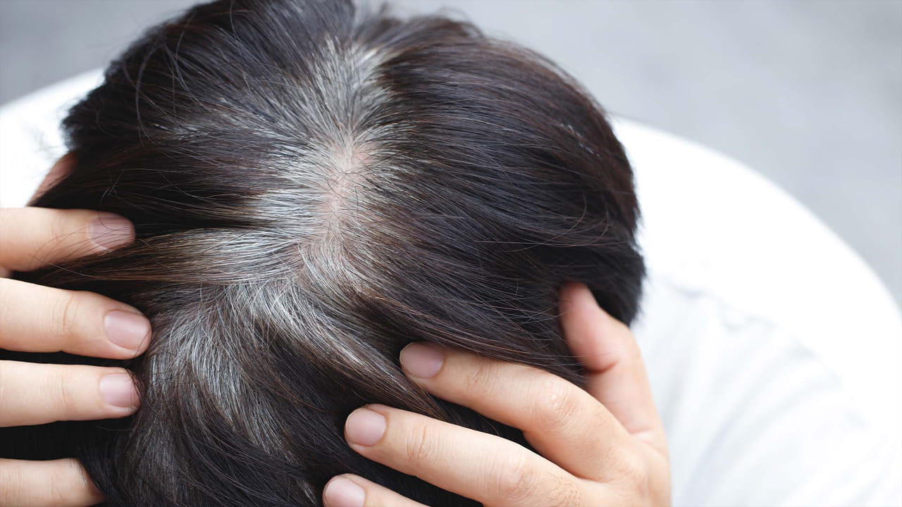 Premature Greying Hair: చిప్స్ తినే అలవాటు మీకూ ఉందా? అయితే త్వరలోనే మీ జుట్టు గోవిందా..