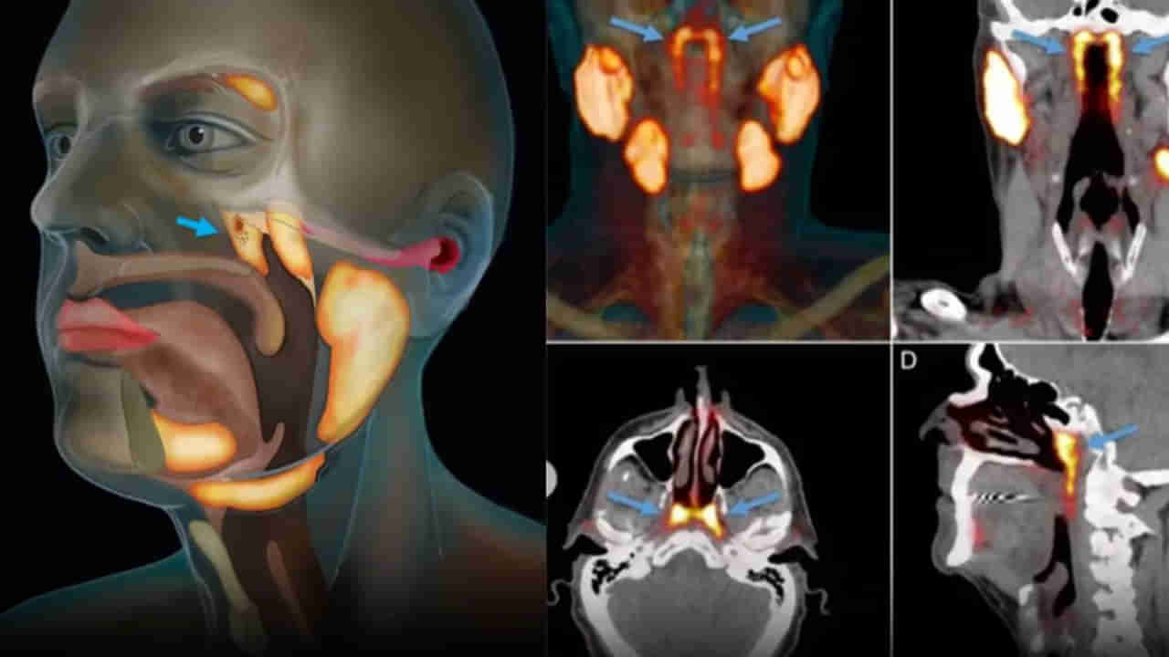 300 ఏళ్ల తర్వాత మానవ శరీరంలో కొత్త అవయవం.. ఇక క్యాన్సర్‌తో పోరు ఈజీ అంటున్న పరిశోధకులు..! అదేంటంటే..